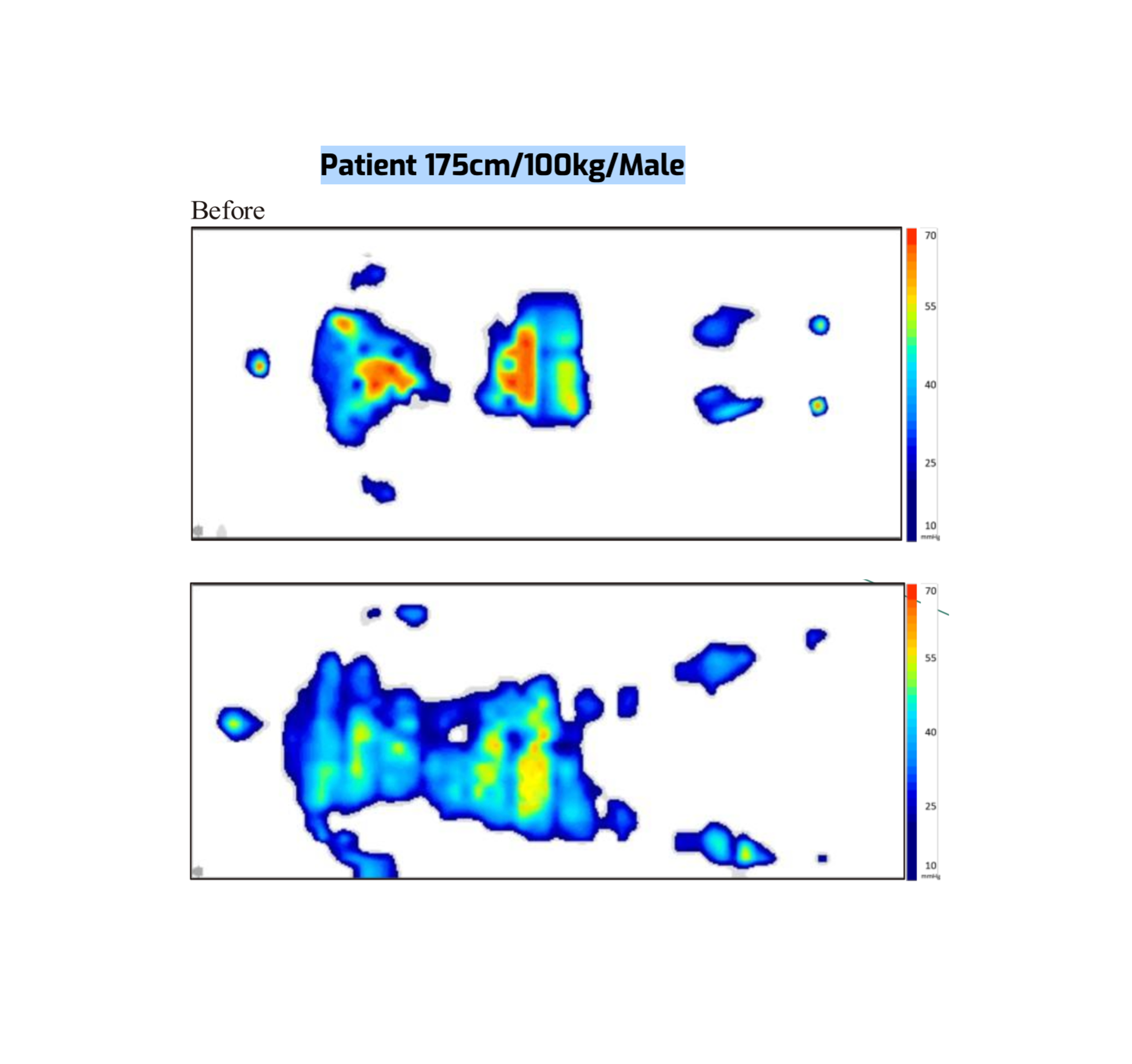 Pressure mapping